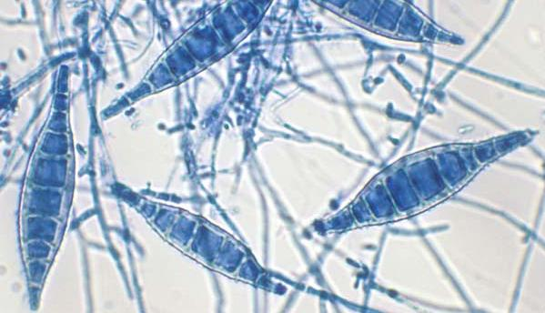 Aspecto microscópico: Fungo filamentoso hialino com hifas