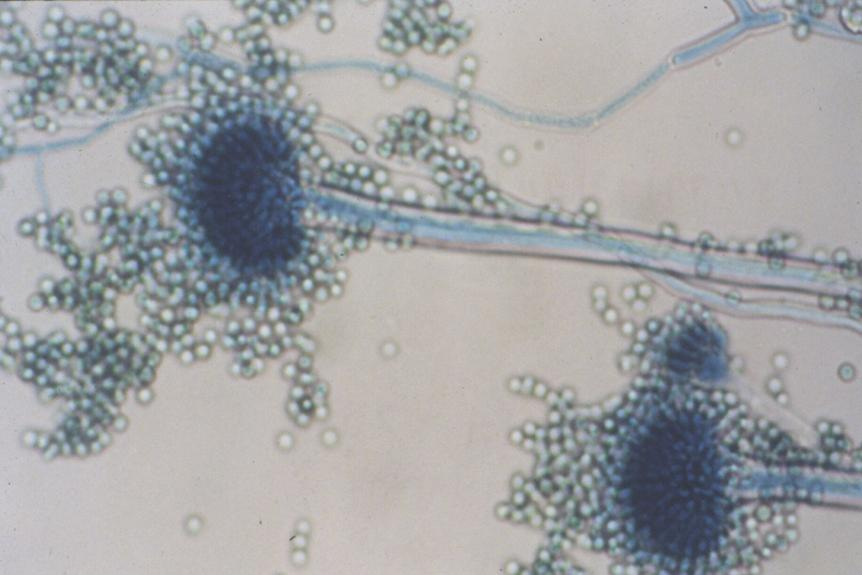 Aspergillus sp Aspecto macroscópico: colônia algodonosa coberta por grânulos que dão a