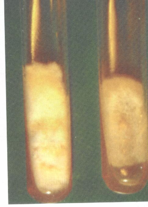 Fusarium sp Aspecto macroscópico: côlonia algodoada que pode apresentar que pode apresentar