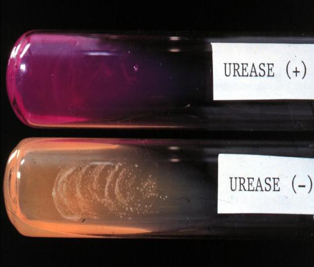 Cryptococcus neoformans Ágar-uréia Leveduras urease +,