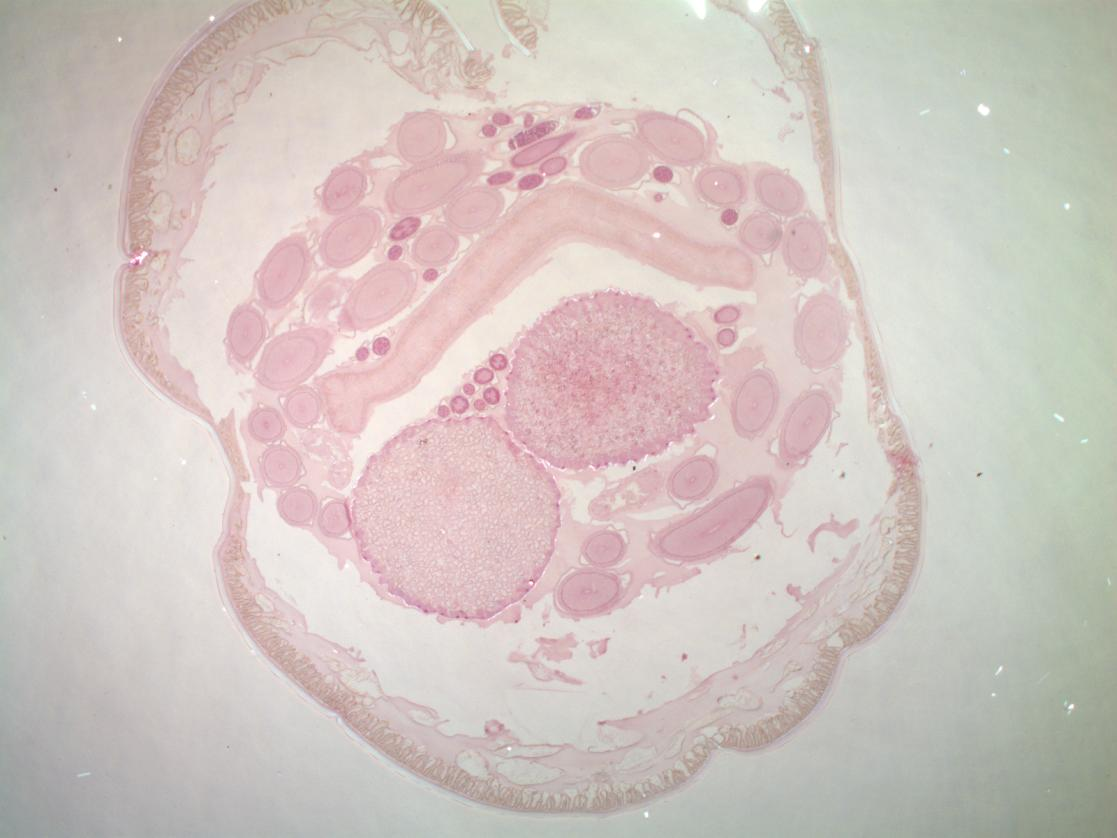Fotomicroscopia. Corte transversal do verme Ascaris lumbricóides.
