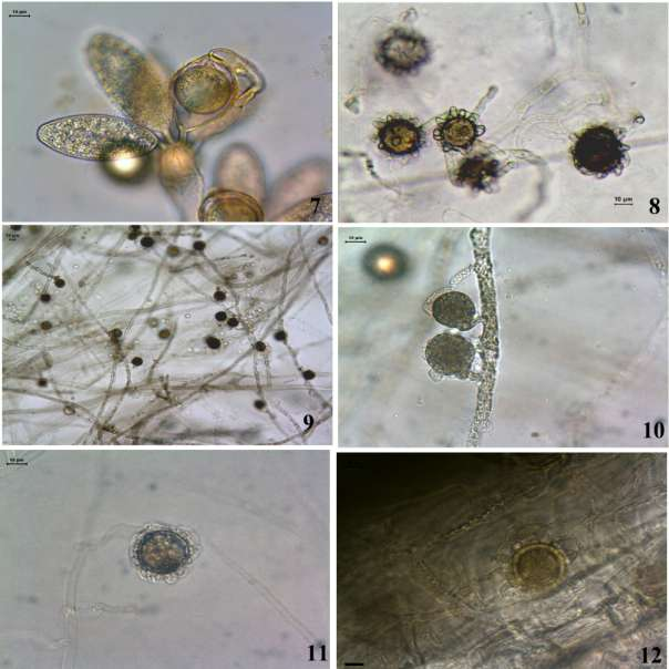 30 resistência localizados internamente nas hifas do micélio vegetativo, ovais, 15,0 22,5 x 10,0 12,5 µm, algumas vezes esféricos, 12,5 22,5 µm diâm. Material examinado: BRASIL.