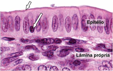 túbulos proximais do rim Possuem filamentos de actina Especializações