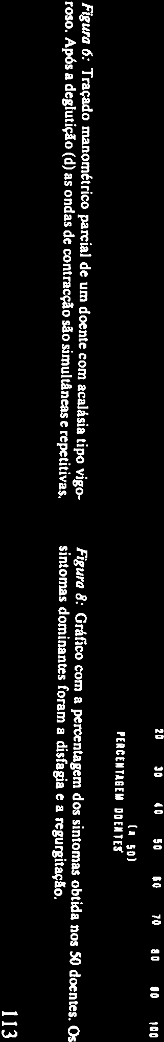 do estômago). A disfagia para sólidos e líquidos foi o único sintoma constante (100% dos doentes).