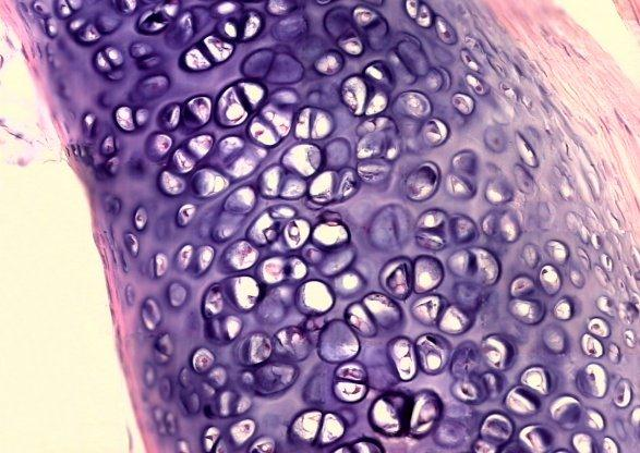 Tecido cartilaginoso Células: Condroblastos