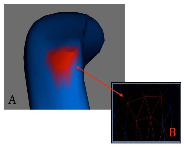 goníaco B. Demarcação dos triângulos na malha 3D Figura 12 - A.