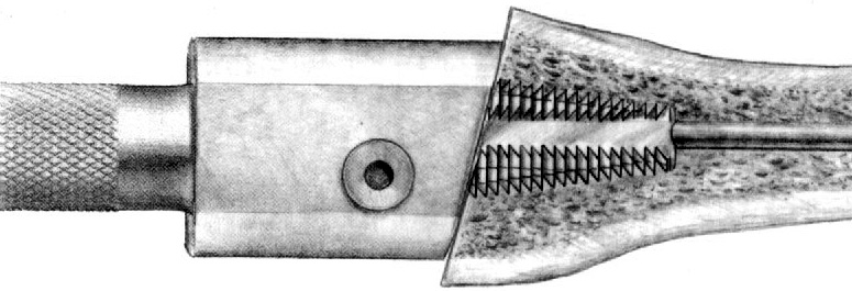 Fig. 7 Um componente radial de teste é inserido utilizando o impactor, com cuidado para manter o alinhamento correto dentro da metáfise preparada.