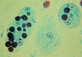 15 Citoplasma Eritrócitos Cariossoma A B Fonte: www. dpd.