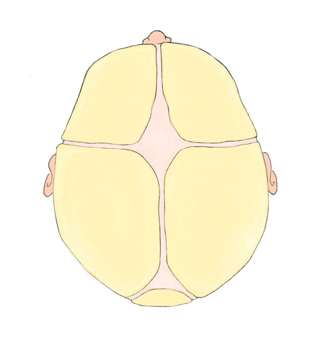 Osso Frontal Fontanela Bregmática Osso Parietal Fontanela Lambdática Escama do Occipital Figura 4- Ossos do Neurocrânio com ossificação membranosa e glabelas.