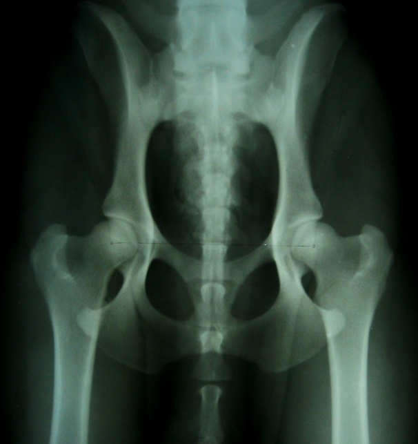 102º 105º 96º 91º Figura 9- Radiografia pélvica de cão da raça Labrador Retriever de 18 meses de idade com displasia coxofemoral leve. Os ângulos de Norberg são 102 e 105.