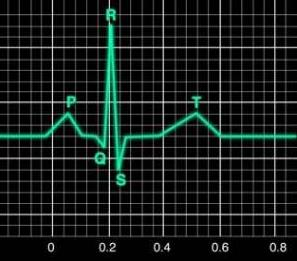 ELETROCARDIOGRAMA O trabalho cardíaco produz sinais elétricos que passam para os tecidos vizinhos e chegam à pele.