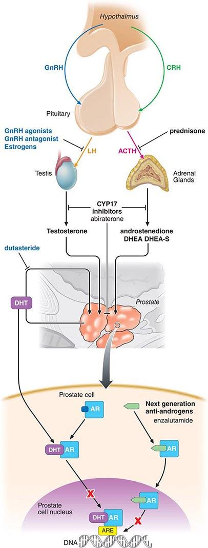 psicológica é reduzida. A orquidectomia subcapsular bilateral é atualmente preferida em relação à total, estando associada a menos complicações pós-operatórias (Roosen JU et al, 2005).