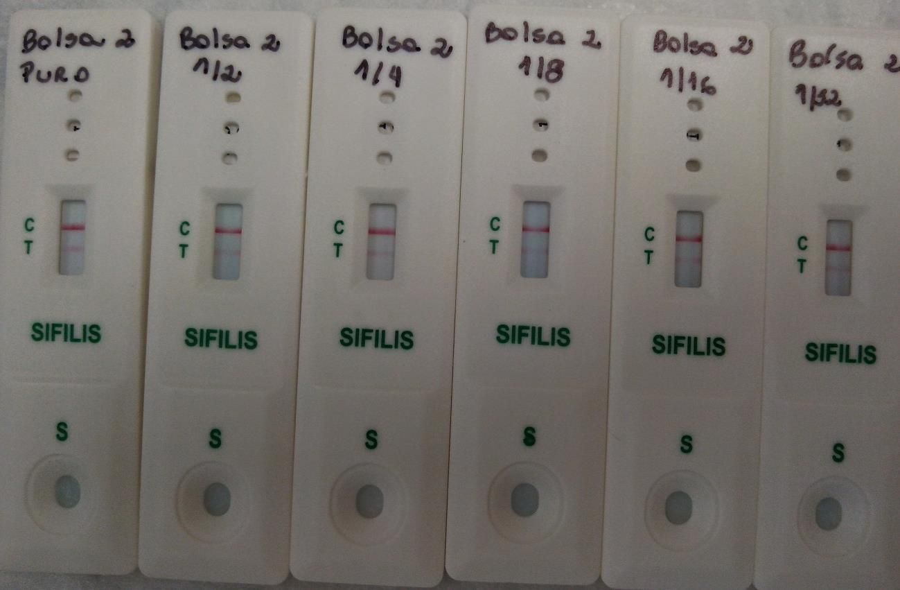 Figura 4: Caracterização da amostra de plasma reagente para sífilis com o kit