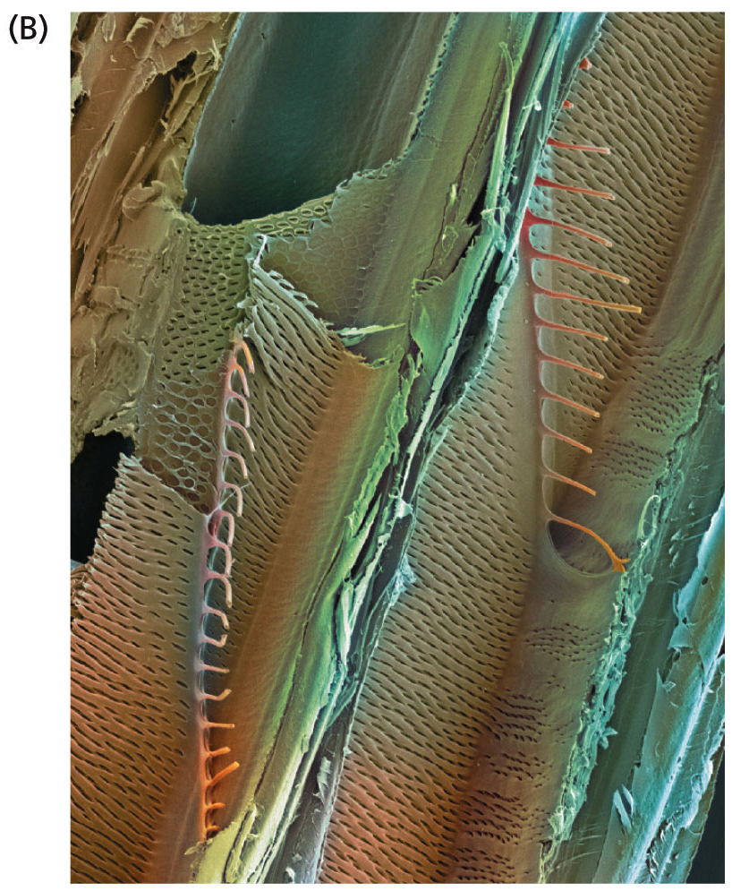 Elementos traqueais: eletromicrografia