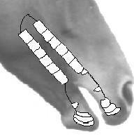 M3 M2 M1 Dente de lobo PM4 PM3 PM2 PM1 C HETERODONTE: caracteriza-se por possuir diversos grupos de dentes, cada um provido de determinadas