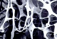 O esqueleto axial apresenta principalmente ossos achatados, tais como os ossos do crânio e da mandíbula. De acordo com a estrutura que exibe, denomina-se cortical (compacto) ou trabecular (esponjoso).