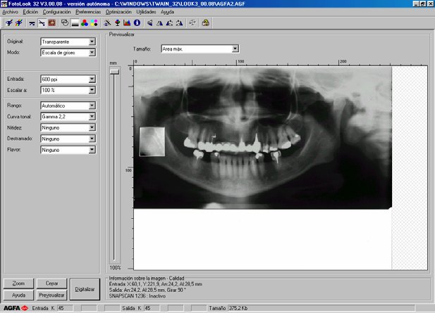 29 Gamma 2,2. A digitalização das imagens foi realizada individualmente após a análise das regiões de estudo de cada radiografia. Fig.