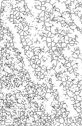 46 Fig. 37- Radiografia panorâmica n 14RD com fragilidade óssea, altos pontos pretos (13,790%) e altos pontos terminais (6,176%) Fig.