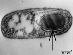 Ciclo de vida de uma bactéria formadora de endósporos.