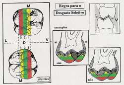 Se a cúspide vestibular do PMI oclui dentro da área 1 ou 2, o