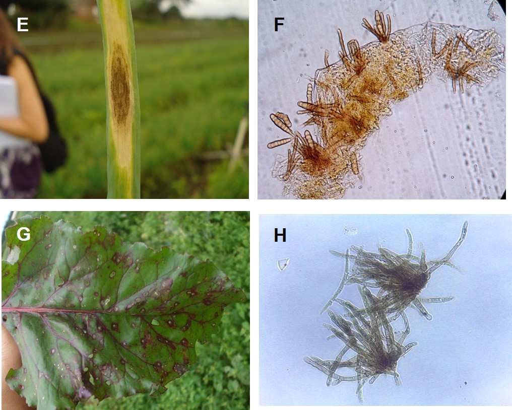 Figura 1. E) Sintoma de mancha púrpura, causada por Alternaria porri, em cebolinha verde; F) Conídios de A.