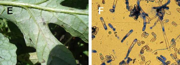 Figura 8. E) Crescimento branco pulverulento de Oidium sp. sobre folhas de melancia; E) Os conídios de Oidium sp.