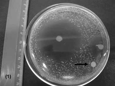 bacteriano que pudesse vir a interferir na interpretação dos demais halos (Figura 10).