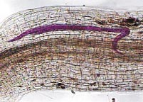 reniformis com a região anterior no cilindro central e a porção dilatada do corpo externa à raiz; E) Fotomicrografia de uma fêmea adulta de R.