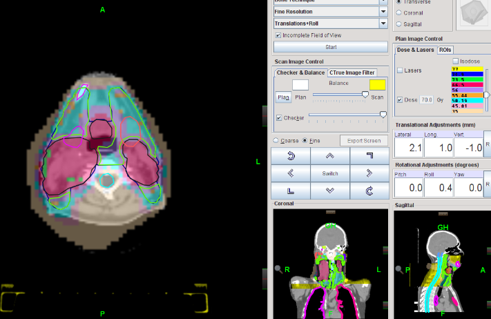 31: Representação gráfica do software da Tomoterapia a partir da qual é possível executar deslocamentos translacionais ao nível vertical, longitudinal e lateral e deslocamentos rotacionais ao nível