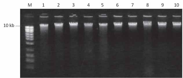 18 Figura 2: Gel de agarose 1 % corado com brometo de etídeo, mostrando extrações de DNA de soldados.