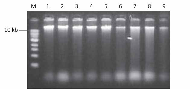 1 10: soldados. Figura 3: Gel de agarose 1 % corado com brometo de etídeo, mostrando extrações de DNA de rainhas.