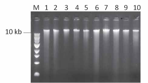 19 Figura 4: Gel de agarose 1 % corado com brometo de etídeo, mostrando extrações de DNA de machos. A presença de bandas acima de 10 kb indica o sucesso da extração do DNA total.