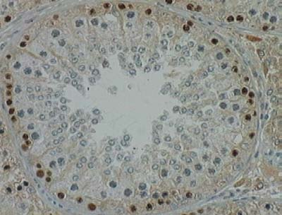 78 Figure 3- spermatogonia