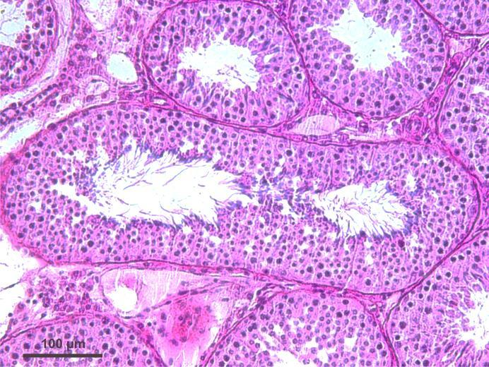 germinativas aglomeradas no lúmen e presença de discreta vacuolização nas células do