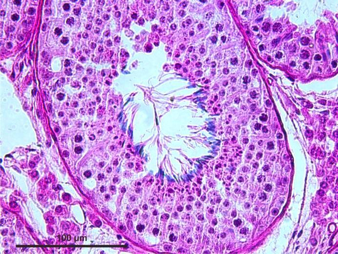 germinativas com proeminência citoplasmática das células de Sertoli, caracterizando