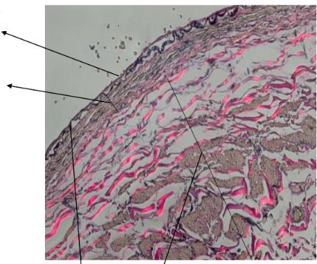 Veia Túnica ou camada íntima