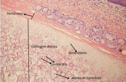 Cartilagem Hielina (Traqueia) -Pericôndrio -Cartilagem