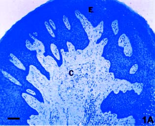 Figuras 1A-D 1A - Fotomicrografia de pólipo pulpar corado em azul de toluidina.