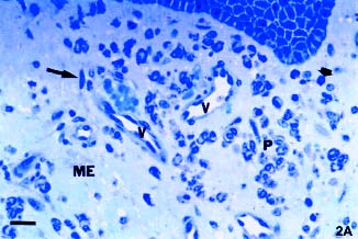 Mastócito (seta) entre as células basais. Barra = 11 µm.
