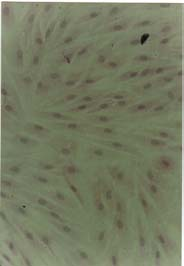 A B C D E Figura 1: Efeito citopático de SRLV em células de membrana sinovial ovina