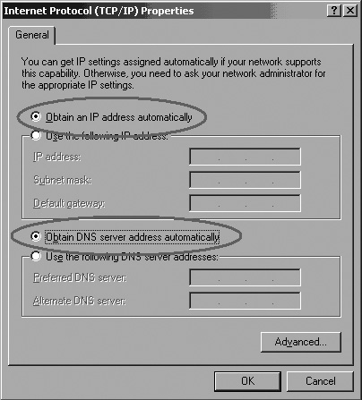 Seleccione aqui as opções Obter um endereço IP automaticamente (Obtain an IP adress automatically) e Obter endereço do servidor DNS automaticamente (Obtain DNS server adress