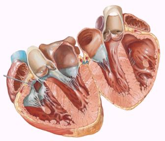 ventrículo esquerdos com a valva atrioventricular esquerda (mitral) removida