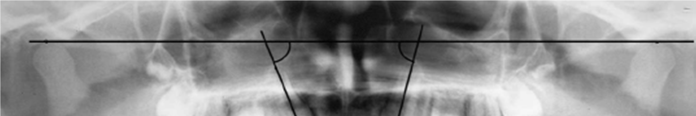 Introdução Ainda no estudo realizado por Warford et al. (2003), cujo objectivo era verificar o método de Lindauer et al.