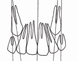 47 Figura 4.1 Desenho em papel Ultraphan das estruturas anatômicas e linhas de referência.