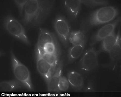 Há estudos em curso por alguns grupos de pesquisa com a finalidade de estabelecer sua identidade imunológica (Figura 4).