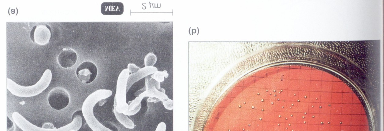 Células bacterianas na superfície