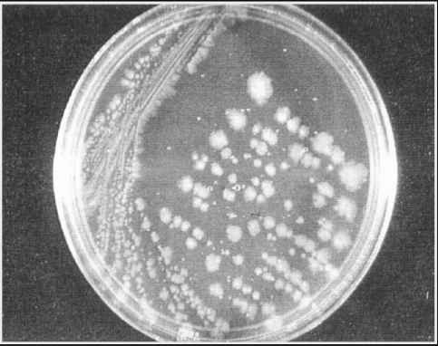 Produz mais de 17 toxinas PRINCIPAIS alfa, beta, epsilon, iota Mionecrose