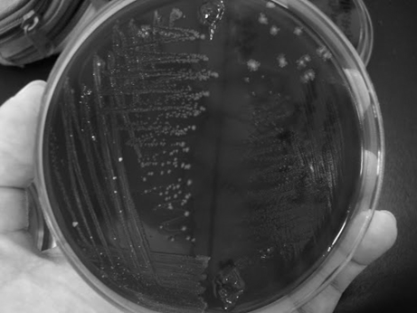 Fusobacterium spp.