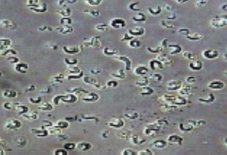 Pseudokirchneriella subcapitata - Microalga unicelular -Clorophyta - Habitat: em massas de água