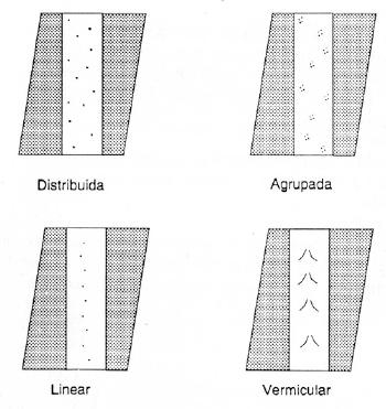 Porosidade Tipos de